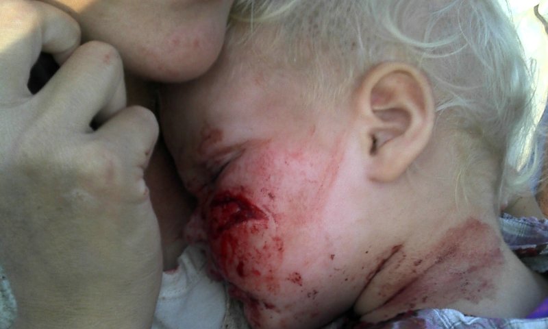 תינוק פצוע. צילום ארכיון