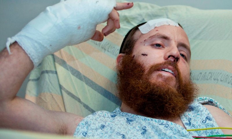 Rabbi Scharf during his injury. Photo: Flash 90