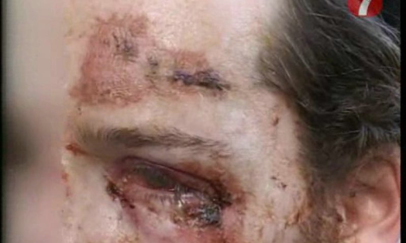 אברך שהותקף באשדוד בעבר. צילום אילוסטרציה: ערוץ 7