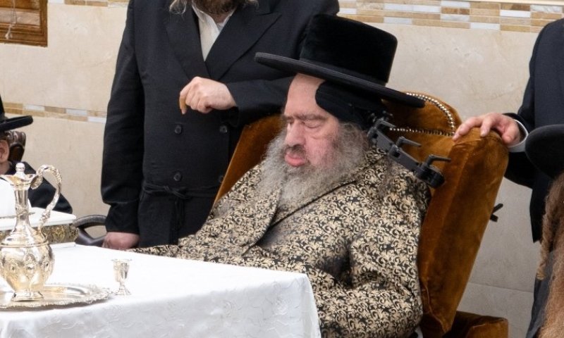 האדמו"ר שמתקשר דרך עיניו סובל מדימום וזקוק לרחמי שמים