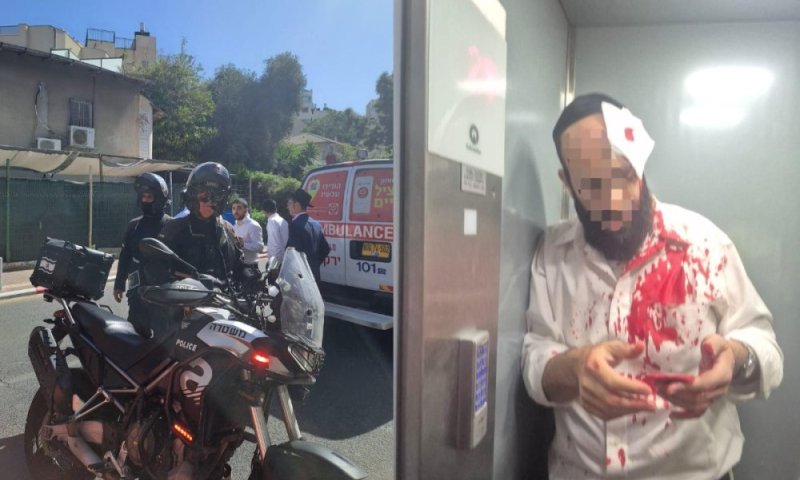 אלימות קשה בבני ברק: ראש הכולל ניסה לסייע לאלמנה - והוכה ע"י שוטרים