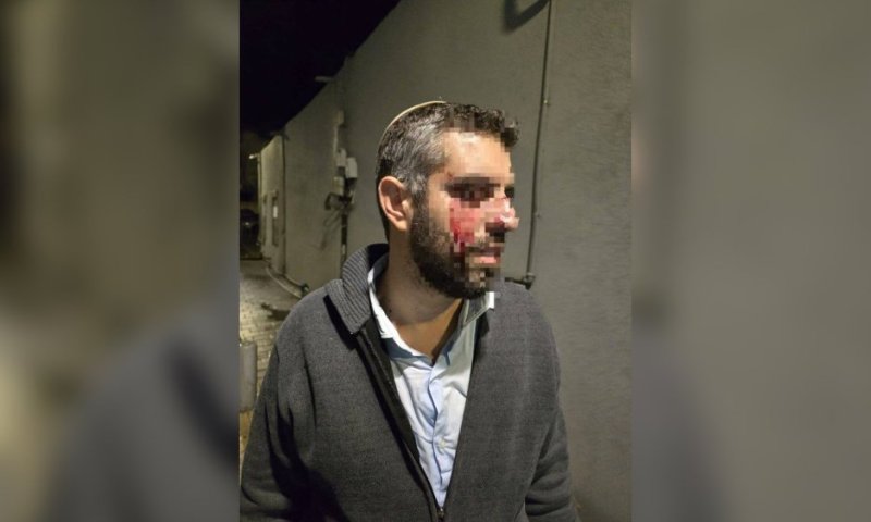 יפו: רב בישיבת ההסדר הותקף ברחוב; סריקות אחר חשודים במעשה