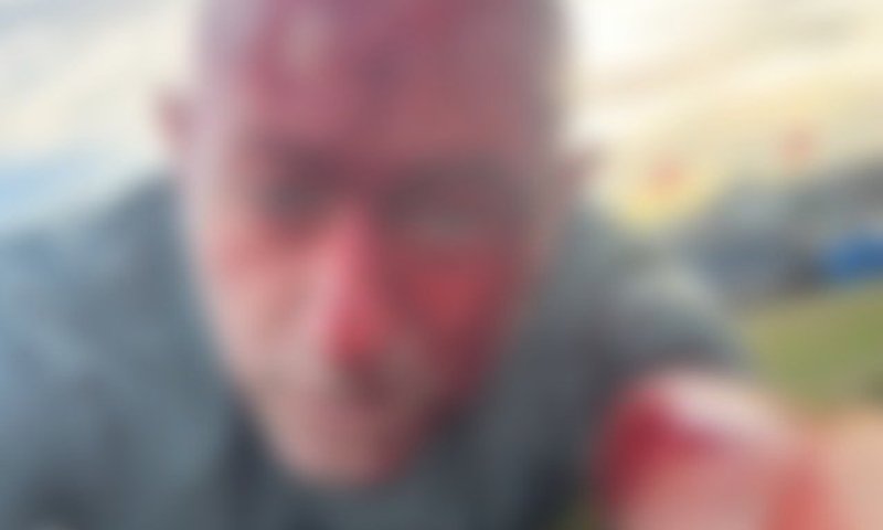 ניצול הטבח בסידני משחזר את הרגעים הקשים: "הבדל של מילימטרים, נס חנוכה"