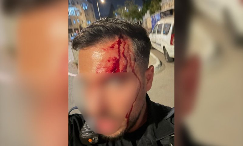 שוטר הותקף במודיעין עילית ונפצע בראשו, תושב העיר נעצר
