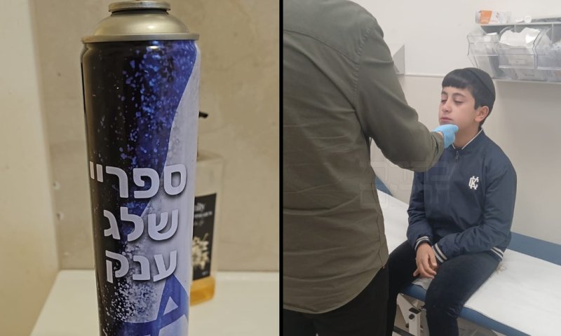 הסכנה במשחק של פורים: בן 12 סובל מכוויות בעיניו לאחר ששיחק בספריי שלג 