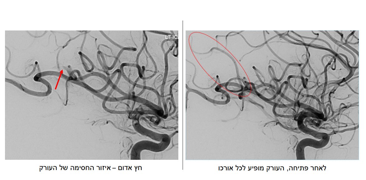 שערי צדק