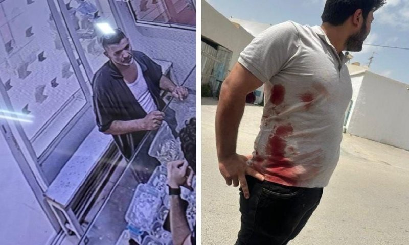 יהודי נפצע בתקיפת גרזן בג'רבה; המשטרה פתחה בחקירה
