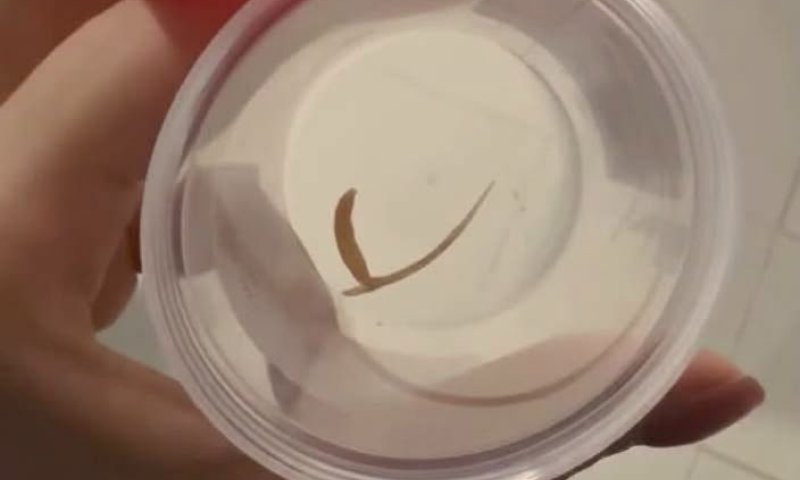 ארוחת הצהריים שכמעט הסתיימה באסון: עצם דג נתקעה בגרונו של קשיש וסיכנה את חייו