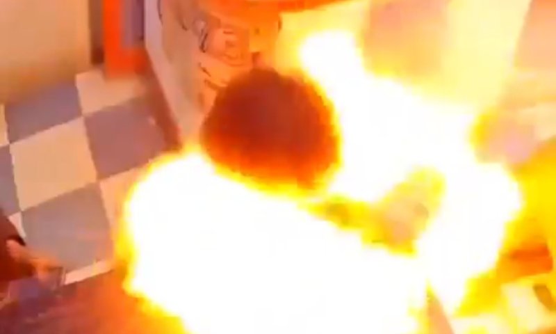 מה הוא חשב לעצמו? צעיר נגס בסוללת טלפון - שהתפוצצה בפיו