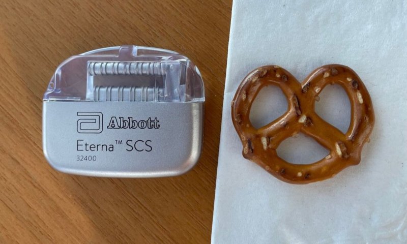 לראשונה בישראל: בוצעה השתלת קוצב הכאב הקטן ביותר בעולם
